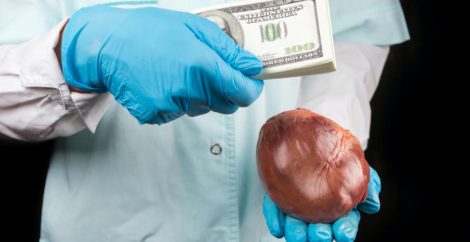 Cambio de dinero por órganos